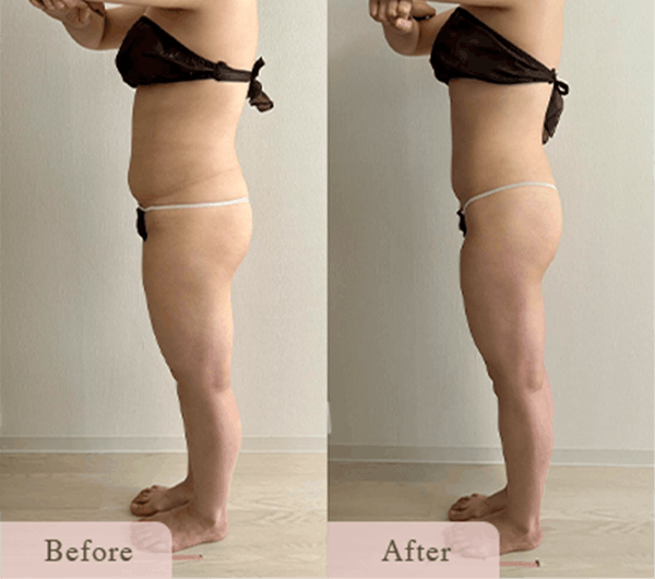 ba-01 - Titania|堺市ダイエットエステサロン 堺市ダイエットエステ|寝てるだけでLLサイズがMサイズに|人生最後のダイエット Titania-ティターニア-