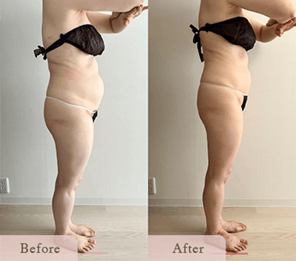 ba-3 - Titania|堺市ダイエットエステサロン 堺市ダイエットエステ|寝てるだけでLLサイズがMサイズに|人生最後のダイエット Titania-ティターニア-