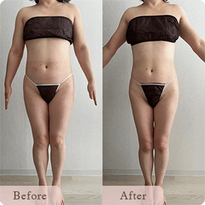 ba-img-1 - Titania|堺市ダイエットエステサロン 堺市ダイエットエステ|寝てるだけでLLサイズがMサイズに|人生最後のダイエット Titania-ティターニア-