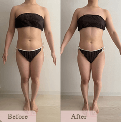 ba-img-10 - Titania|堺市ダイエットエステサロン 堺市ダイエットエステ|寝てるだけでLLサイズがMサイズに|人生最後のダイエット Titania-ティターニア-