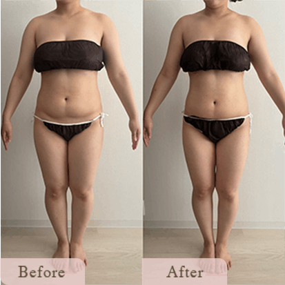 ba-img-11 - Titania|堺市ダイエットエステサロン 堺市ダイエットエステ|寝てるだけでLLサイズがMサイズに|人生最後のダイエット Titania-ティターニア-