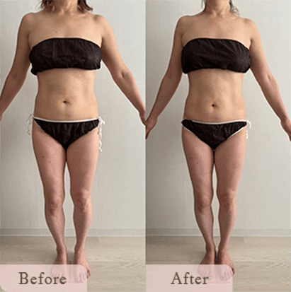 ba-img-13 - Titania|堺市ダイエットエステサロン 堺市ダイエットエステ|寝てるだけでLLサイズがMサイズに|人生最後のダイエット Titania-ティターニア-