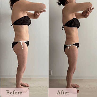 ba-img-14 - Titania|堺市ダイエットエステサロン 堺市ダイエットエステ|寝てるだけでLLサイズがMサイズに|人生最後のダイエット Titania-ティターニア-