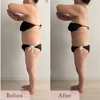 ba-img-15 - Titania|堺市ダイエットエステサロン 堺市ダイエットエステ|寝てるだけでLLサイズがMサイズに|人生最後のダイエット Titania-ティターニア-