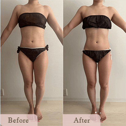 ba-img-17 - Titania|堺市ダイエットエステサロン 堺市ダイエットエステ|寝てるだけでLLサイズがMサイズに|人生最後のダイエット Titania-ティターニア-