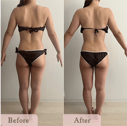 ba-img-18 - Titania|堺市ダイエットエステサロン 堺市ダイエットエステ|寝てるだけでLLサイズがMサイズに|人生最後のダイエット Titania-ティターニア-