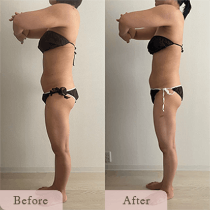 ba-img-19 - Titania|堺市ダイエットエステサロン 堺市ダイエットエステ|寝てるだけでLLサイズがMサイズに|人生最後のダイエット Titania-ティターニア-