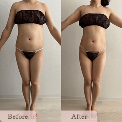 ba-img-2 - Titania|堺市ダイエットエステサロン 堺市ダイエットエステ|寝てるだけでLLサイズがMサイズに|人生最後のダイエット Titania-ティターニア-