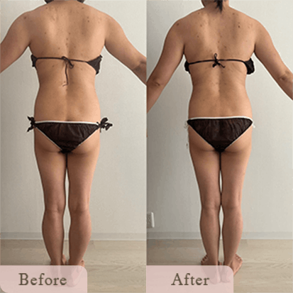 ba-img-20 - Titania|堺市ダイエットエステサロン 堺市ダイエットエステ|寝てるだけでLLサイズがMサイズに|人生最後のダイエット Titania-ティターニア-