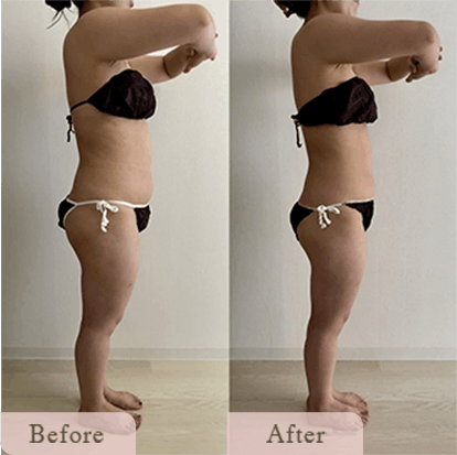 ba-img-21 - Titania|堺市ダイエットエステサロン 堺市ダイエットエステ|寝てるだけでLLサイズがMサイズに|人生最後のダイエット Titania-ティターニア-