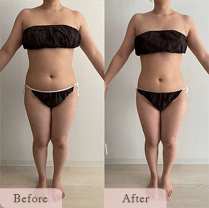 ba-img-22 - Titania|堺市ダイエットエステサロン 堺市ダイエットエステ|寝てるだけでLLサイズがMサイズに|人生最後のダイエット Titania-ティターニア-