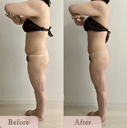 ba-img-5 - Titania|堺市ダイエットエステサロン 堺市ダイエットエステ|寝てるだけでLLサイズがMサイズに|人生最後のダイエット Titania-ティターニア-