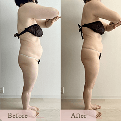 ba-img-6 - Titania|堺市ダイエットエステサロン 堺市ダイエットエステ|寝てるだけでLLサイズがMサイズに|人生最後のダイエット Titania-ティターニア-