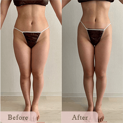 ba-img-8 - Titania|堺市ダイエットエステサロン 堺市ダイエットエステ|寝てるだけでLLサイズがMサイズに|人生最後のダイエット Titania-ティターニア-