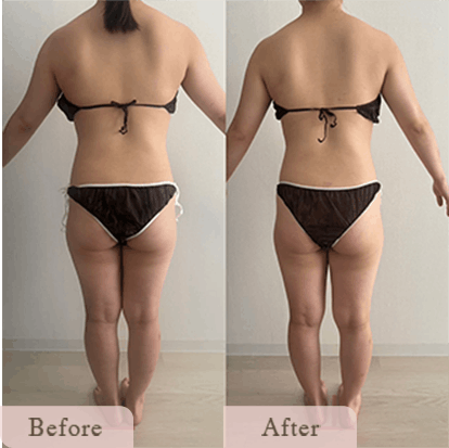 ba-img-9 - Titania|堺市ダイエットエステサロン 堺市ダイエットエステ|寝てるだけでLLサイズがMサイズに|人生最後のダイエット Titania-ティターニア-