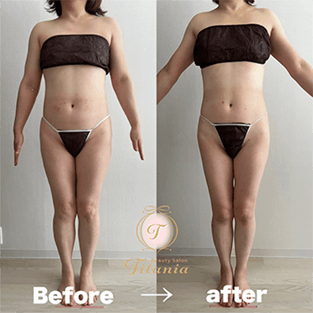 voice-01-2 - Titania|堺市ダイエットエステサロン 堺市ダイエットエステ|寝てるだけでLLサイズがMサイズに|人生最後のダイエット Titania-ティターニア-