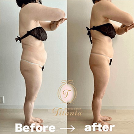 voice-02-2 - Titania|堺市ダイエットエステサロン 堺市ダイエットエステ|寝てるだけでLLサイズがMサイズに|人生最後のダイエット Titania-ティターニア-