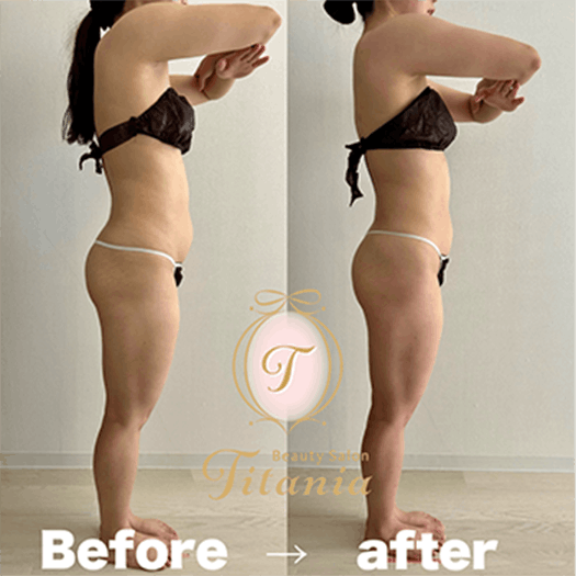 堺市ダイエットエステ｜寝てるだけでLLサイズがMサイズに｜人生最後のダイエット Titania-ティターニア-