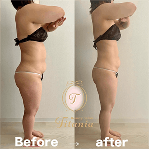 堺市ダイエットエステ｜寝てるだけでLLサイズがMサイズに｜人生最後のダイエット Titania-ティターニア-