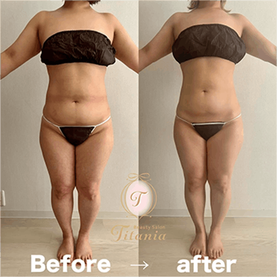 堺市ダイエットエステ｜寝てるだけでLLサイズがMサイズに｜人生最後のダイエット Titania-ティターニア-