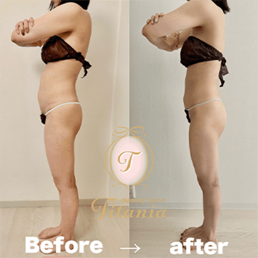 堺市ダイエットエステ｜寝てるだけでLLサイズがMサイズに｜人生最後のダイエット Titania-ティターニア-