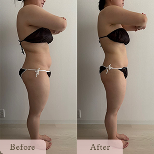 baimg-new-1@1.5x - Titania|堺市ダイエットエステサロン 堺市ダイエットエステ|寝てるだけでLLサイズがMサイズに|人生最後のダイエット Titania-ティターニア-