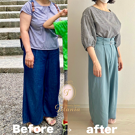 sp-reason-03 - Titania|堺市ダイエットエステサロン 堺市ダイエットエステ|寝てるだけでLLサイズがMサイズに|人生最後のダイエット Titania-ティターニア-