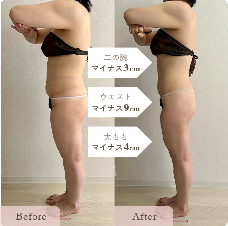 sp-reason-04 - Titania|堺市ダイエットエステサロン 堺市ダイエットエステ|寝てるだけでLLサイズがMサイズに|人生最後のダイエット Titania-ティターニア-